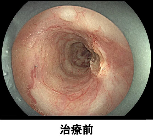 治療前